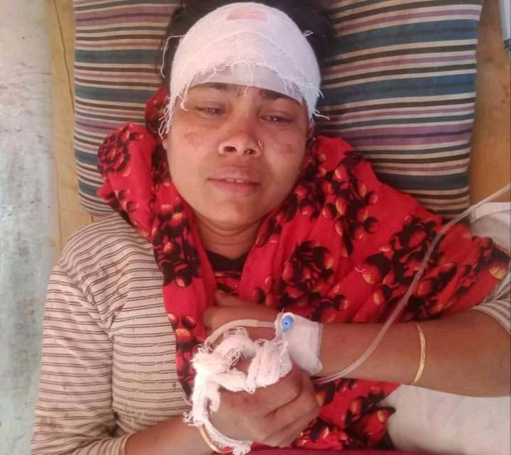 হিজলায় জমি নিয়ে বিরোধকে কেন্দ্র করে ভাই কর্তৃক ভাবীর উপরে হামলা।