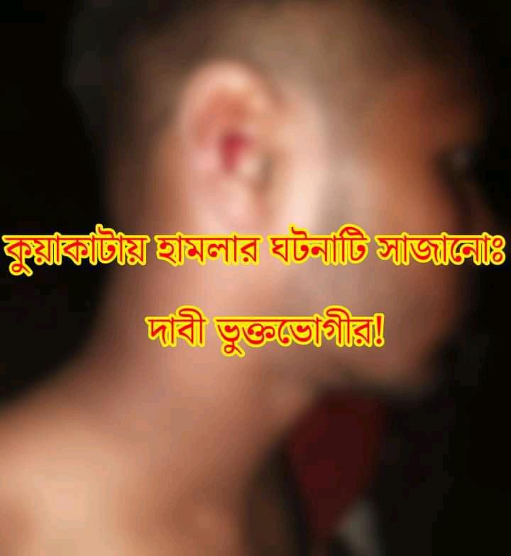 কুয়াকাটায় হামলার ঘটনাটি সাজানোঃ দাবী ভুক্তভোগীর!