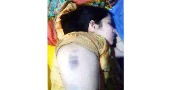শিক্ষক স্বামীর নির্যাতনে শিক্ষিকা স্ত্রী হাসপাতালে
